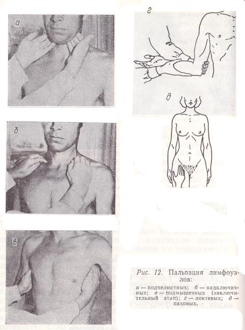 Пальпация лимфоузлов