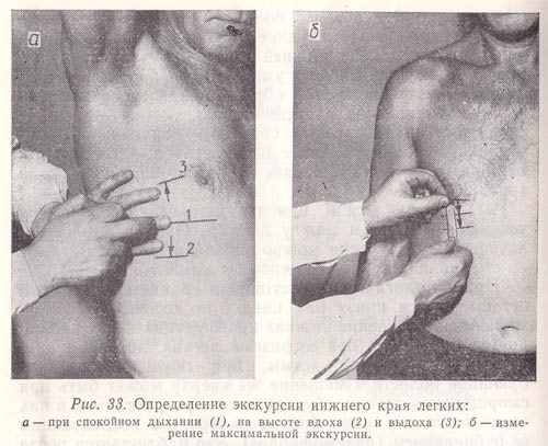 Определение экскурсии нижнего края легких