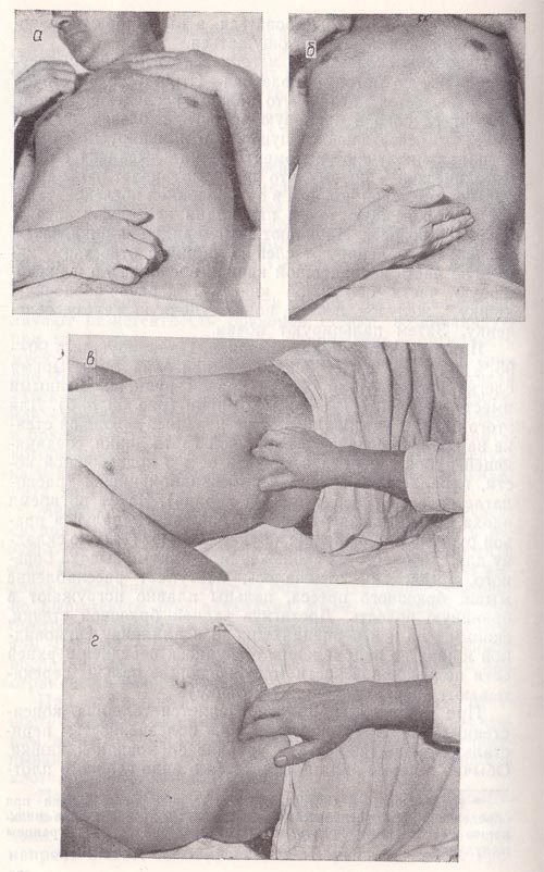 Пальпация сигмовидной   кишки соответственно четырьмя пальцами и локтевым краем мизинца, соответственно слепой и подвздошной кишки