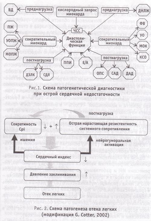 схема патогенетической диагностики острой сердечной недостаточности и схема патогенеза отека легких