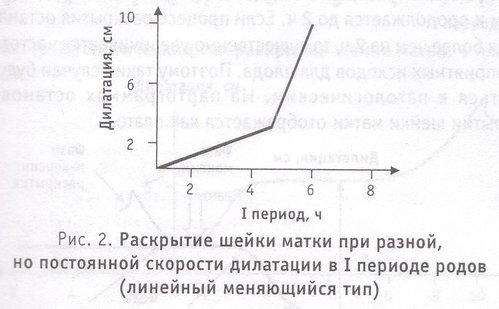 раскрытие шейки матки при разной, но постоянной скорости дилатации в I периоде родов (линейный меняющийся тип)
