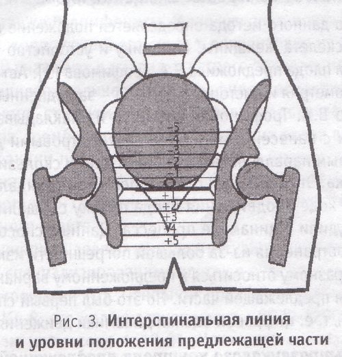 Интерспинальная линия и уровни положения предлежащей части